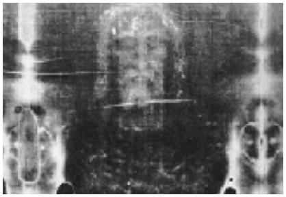 Shroud of Turin